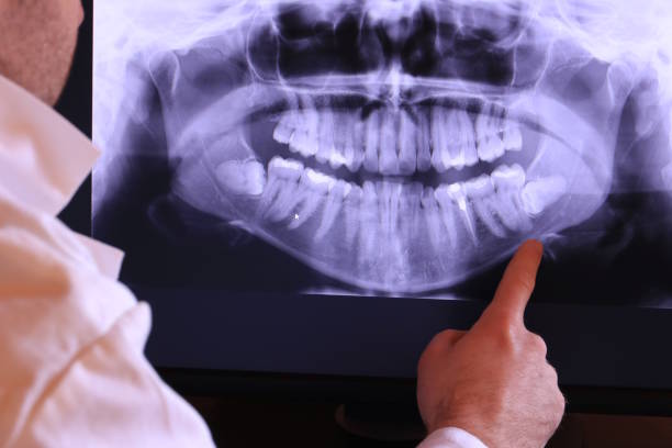Best Broken or Chipped Tooth Repair in Forestville, OH